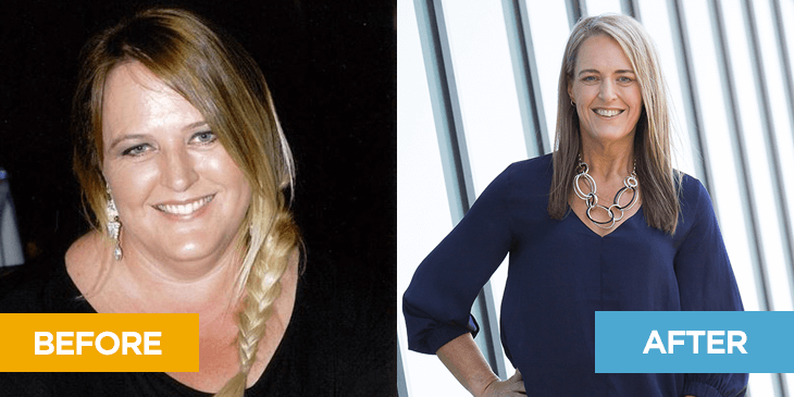 Before and after image of Sarah who lost 83 kg with the Total Wellbeing Diet