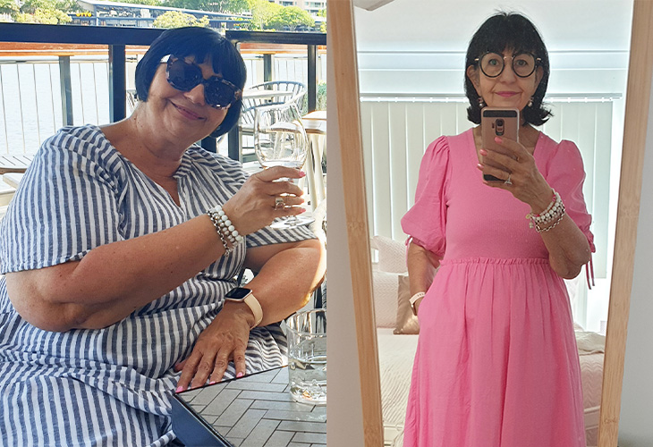 Christine before and after weight loss.