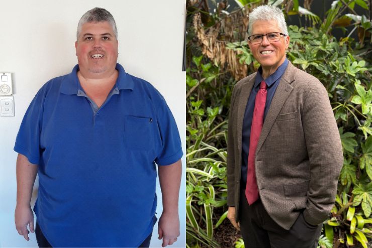Terry before at 185kg and after his 100kg weight loss