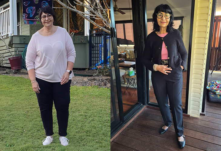 Christine before and after weight loss.